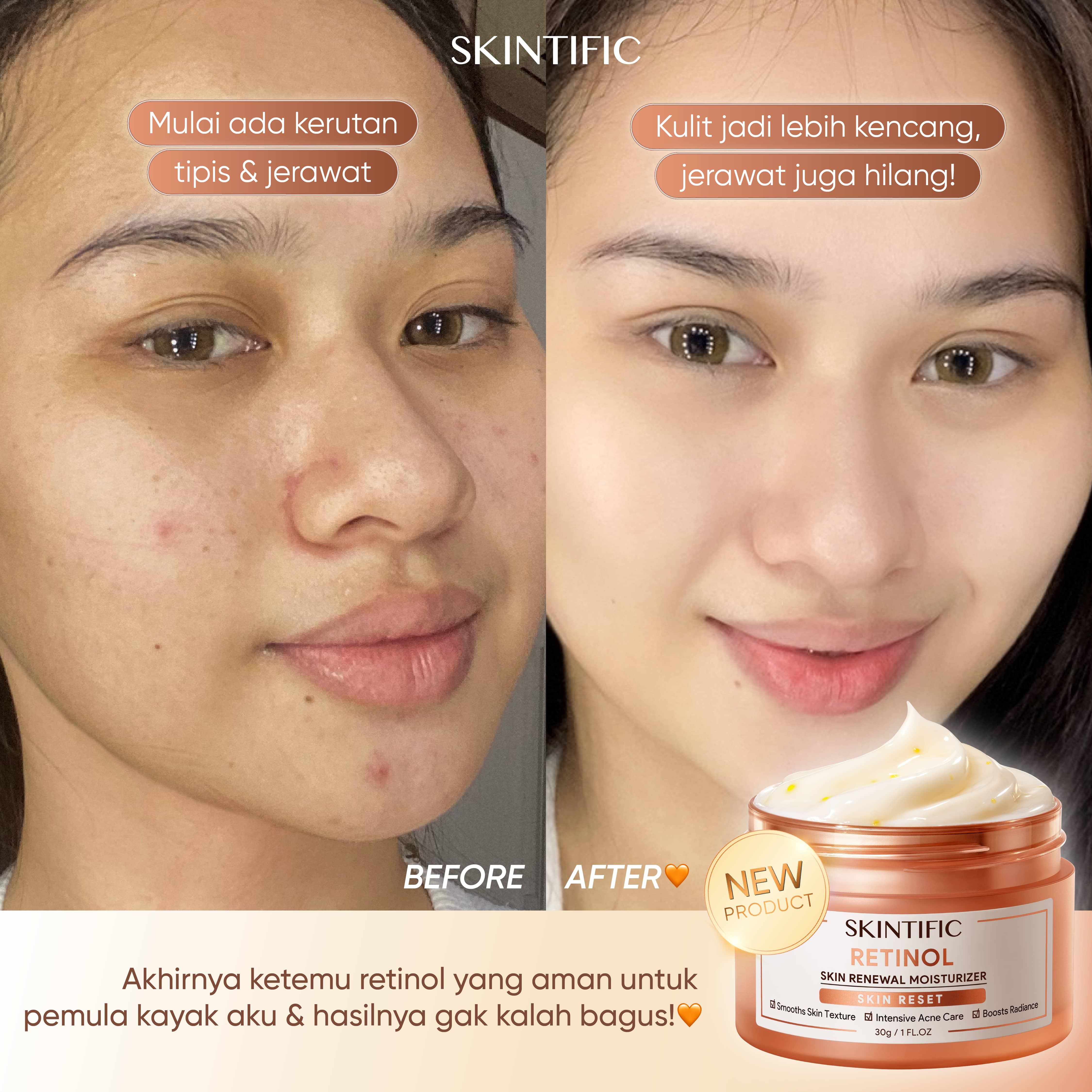 SKINTIFIC Moisturizer Collection
